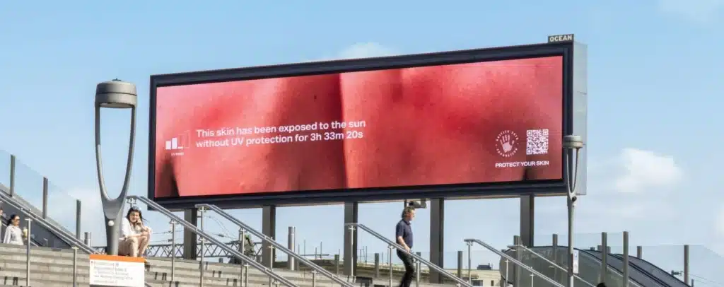AI mostra la pelle che brucia la campagna contro il melanoma più potente mai vista Burnable Billboard British Skin Foundation